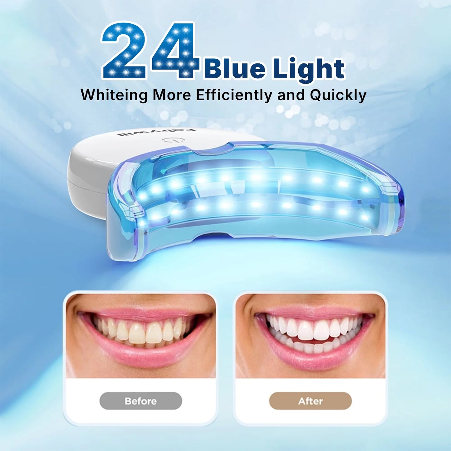 Portable LED Teeth Whitening Kit – Rechargeable Blue Light & 28 Sensitive-Friendly Whitening Strips